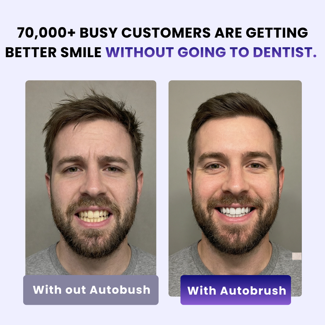 Sonic Pro ToothBrush