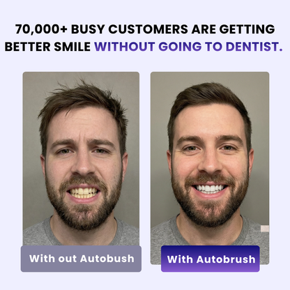 Sonic Pro ToothBrush